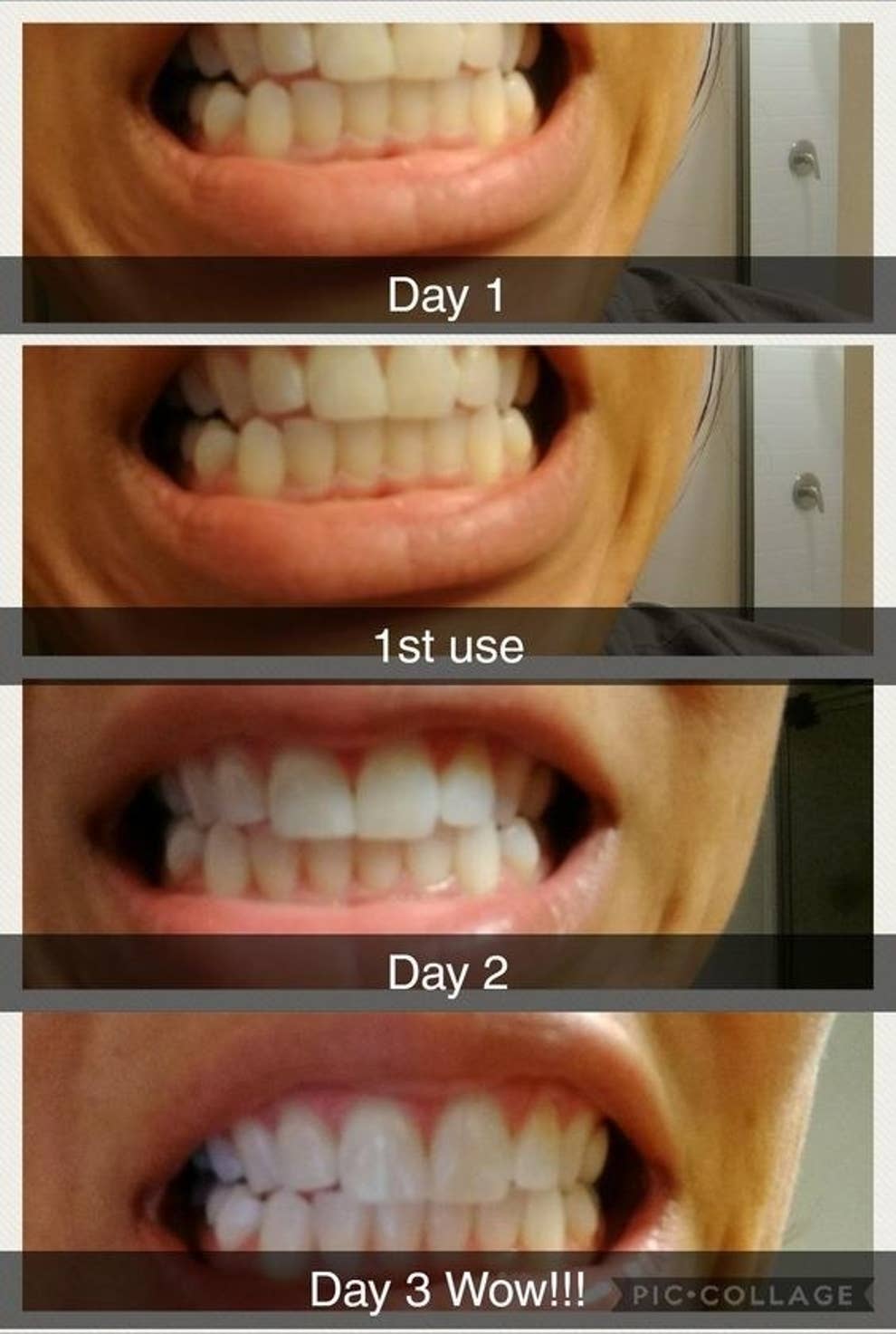 The Greatest Guide To Snow Teeth Whitening Reviews