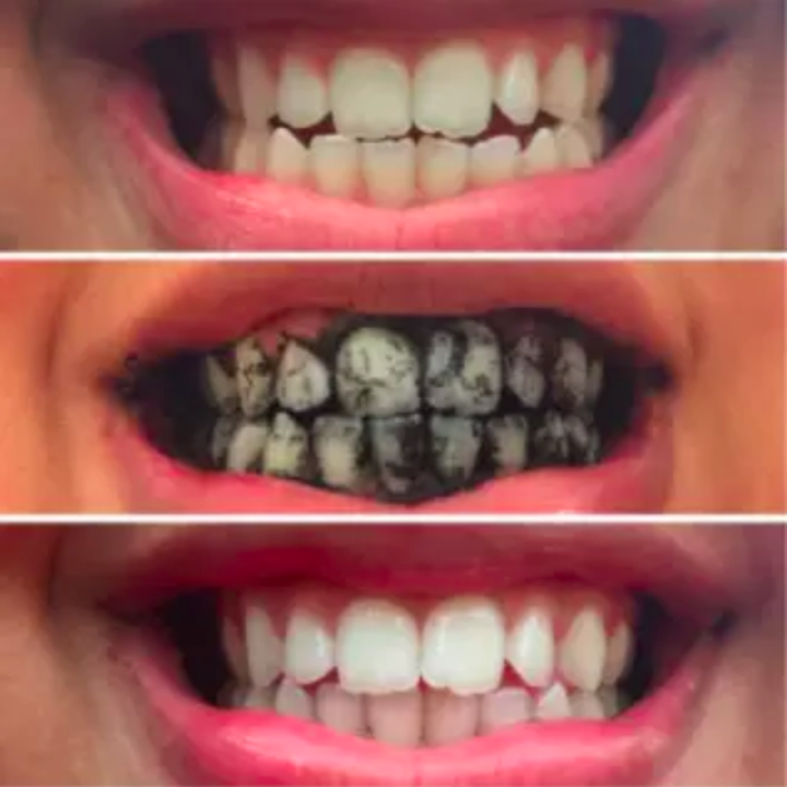 24 Of The Best Teeth Whiteners You Can Get On Amazon