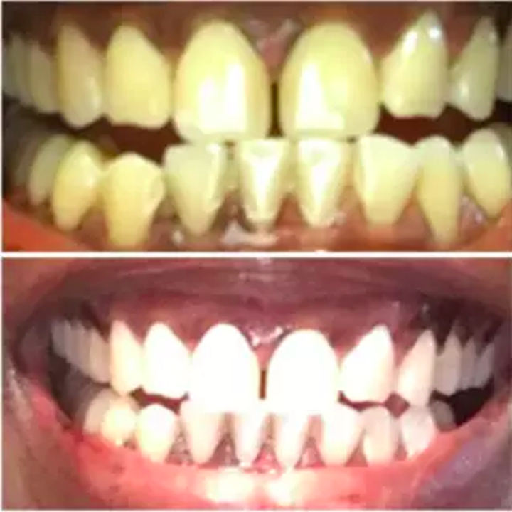 24 Of The Best Teeth Whiteners You Can Get On Amazon