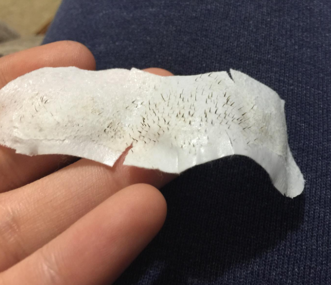 These Amazingly Satisfying Pore Strips  Are A Cult Favorite 