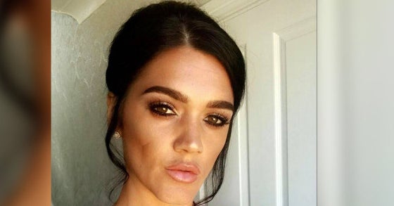 A Mom Of Three Died During A Brazilian Butt Lift Surgery