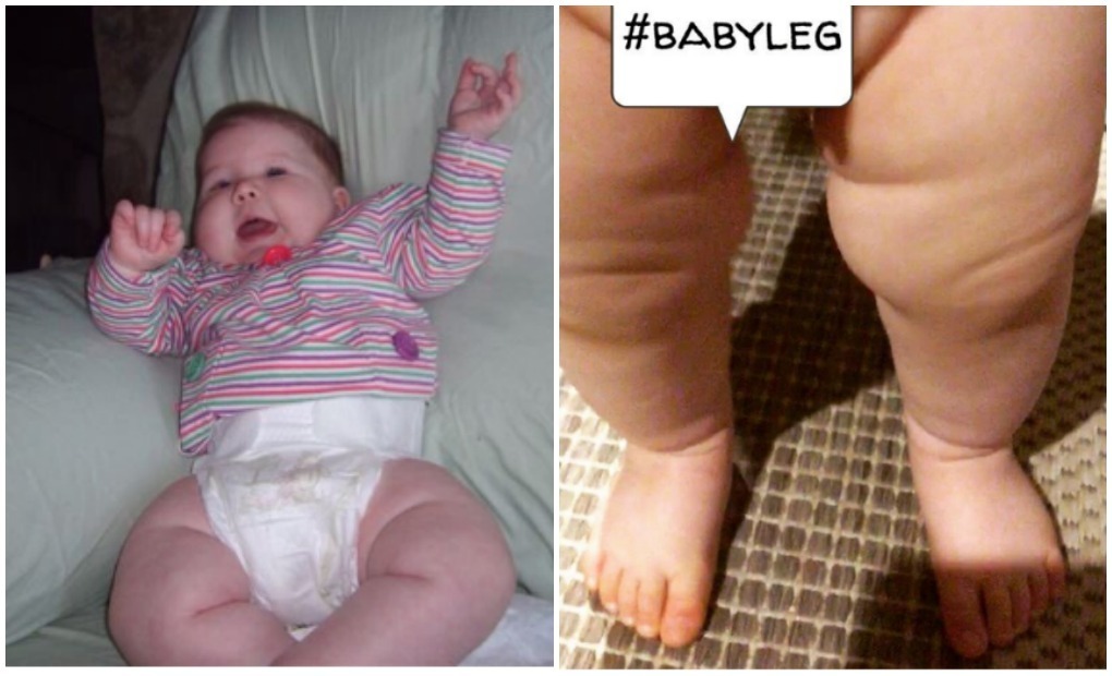 Fat baby sale leg