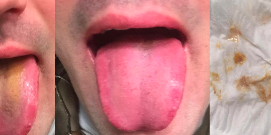 Maked teen medical exam