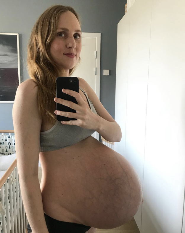 三つ子を妊娠しているお母さんのストーリーと 妊娠による週ごとの美しい体の変化