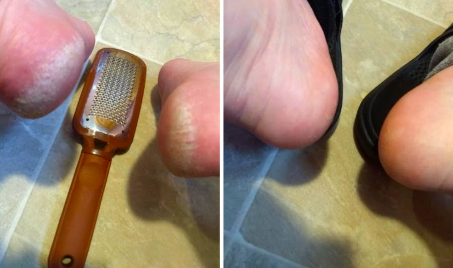 This $8 Pedicure Rasp Will Give You Disgustingly Satisfying