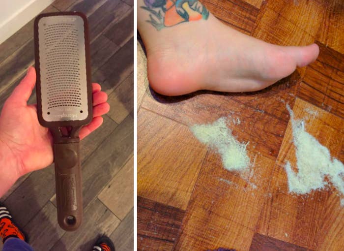 Would a cheese grater effectively scrape off and treat dry skin on cracked  feet as bad as these if you don't have anything else to use? - Quora