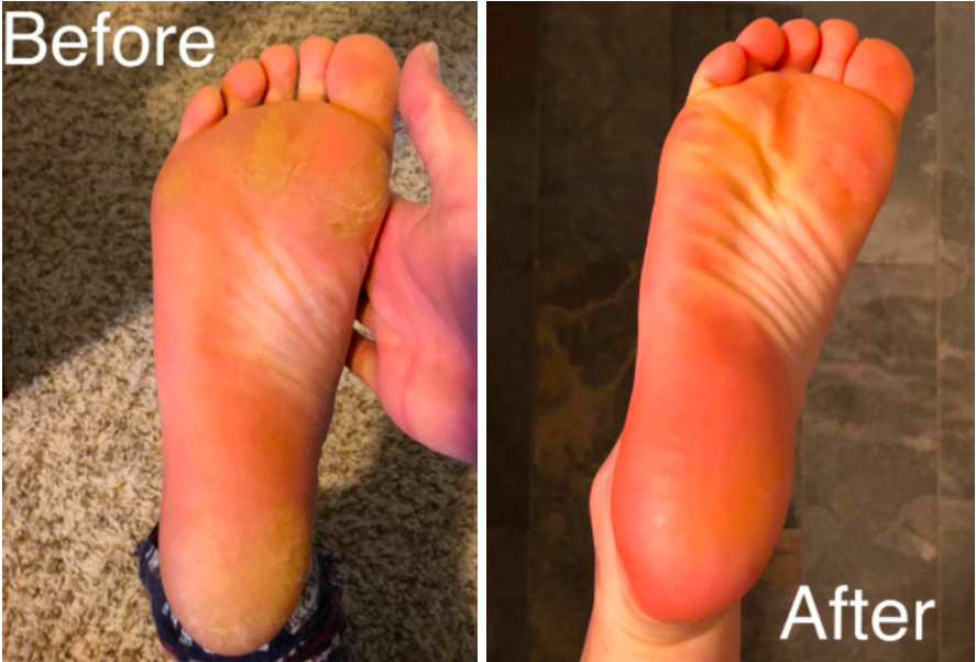 This $8 Pedicure Rasp Will Give You Disgustingly Satisfying Results, And  Super Smooth Feet