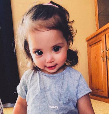 This Little Girl S Big Beautiful Eyes Are Due To A Rare Genetic