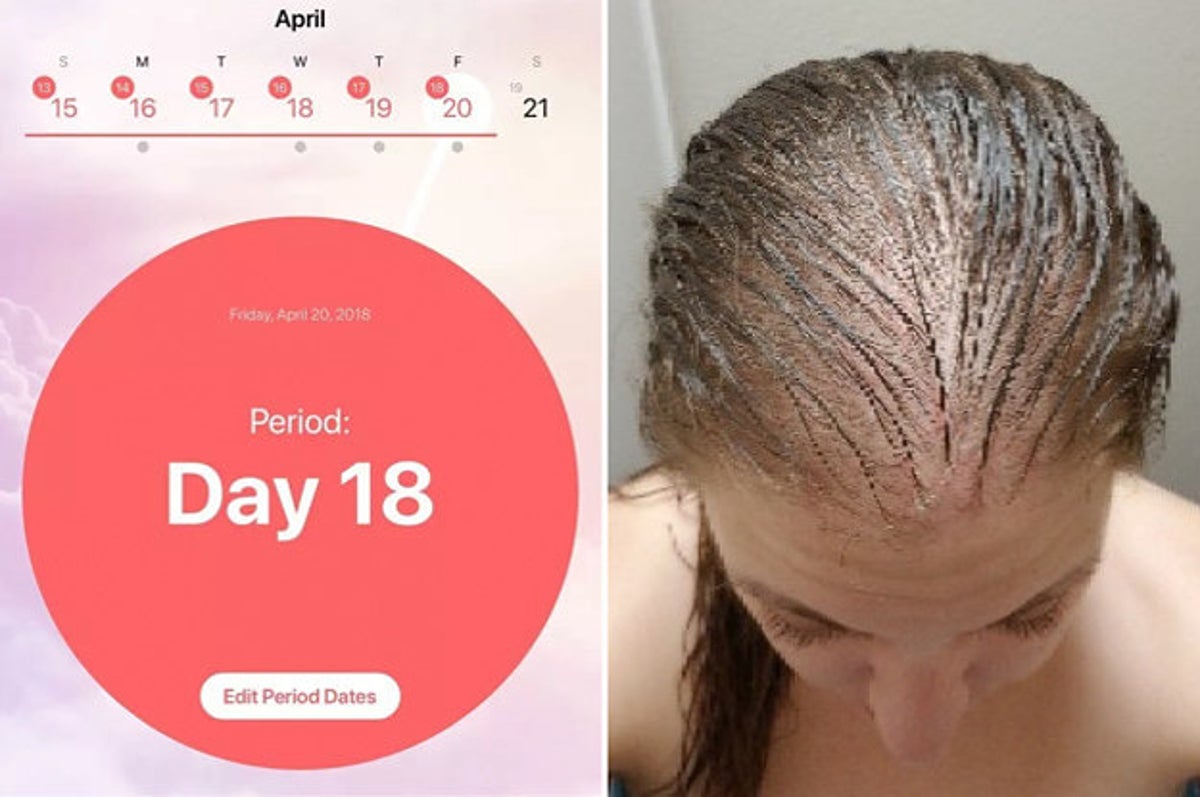 23 Pictures That Show The Reality Of Living With PCOS