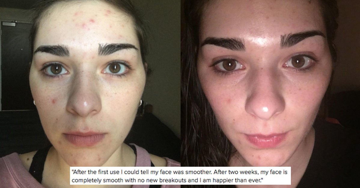 31 Amazing Skin Care Products With Over 1,000 Reviews