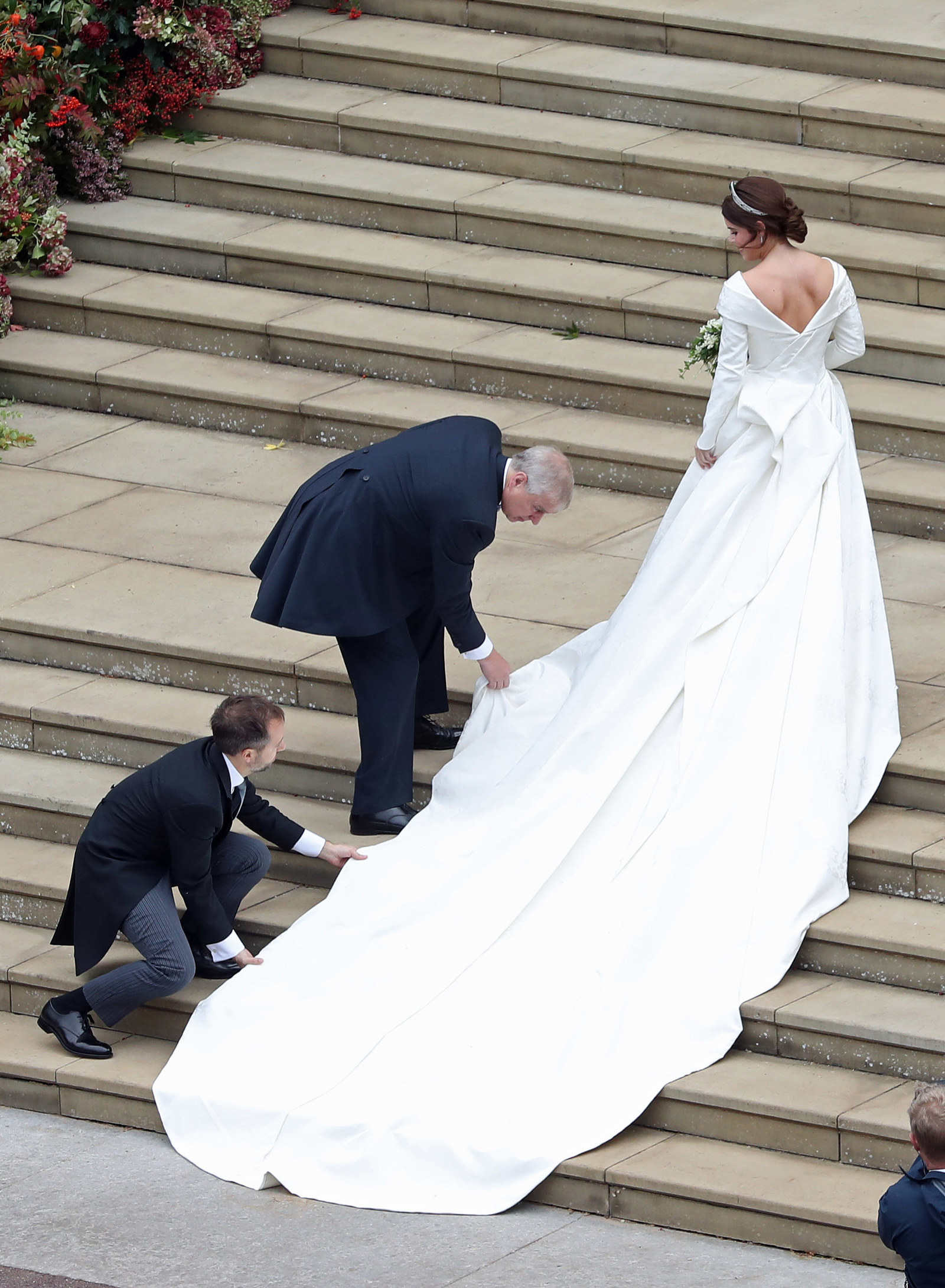 Princess eugenie back clearance scar