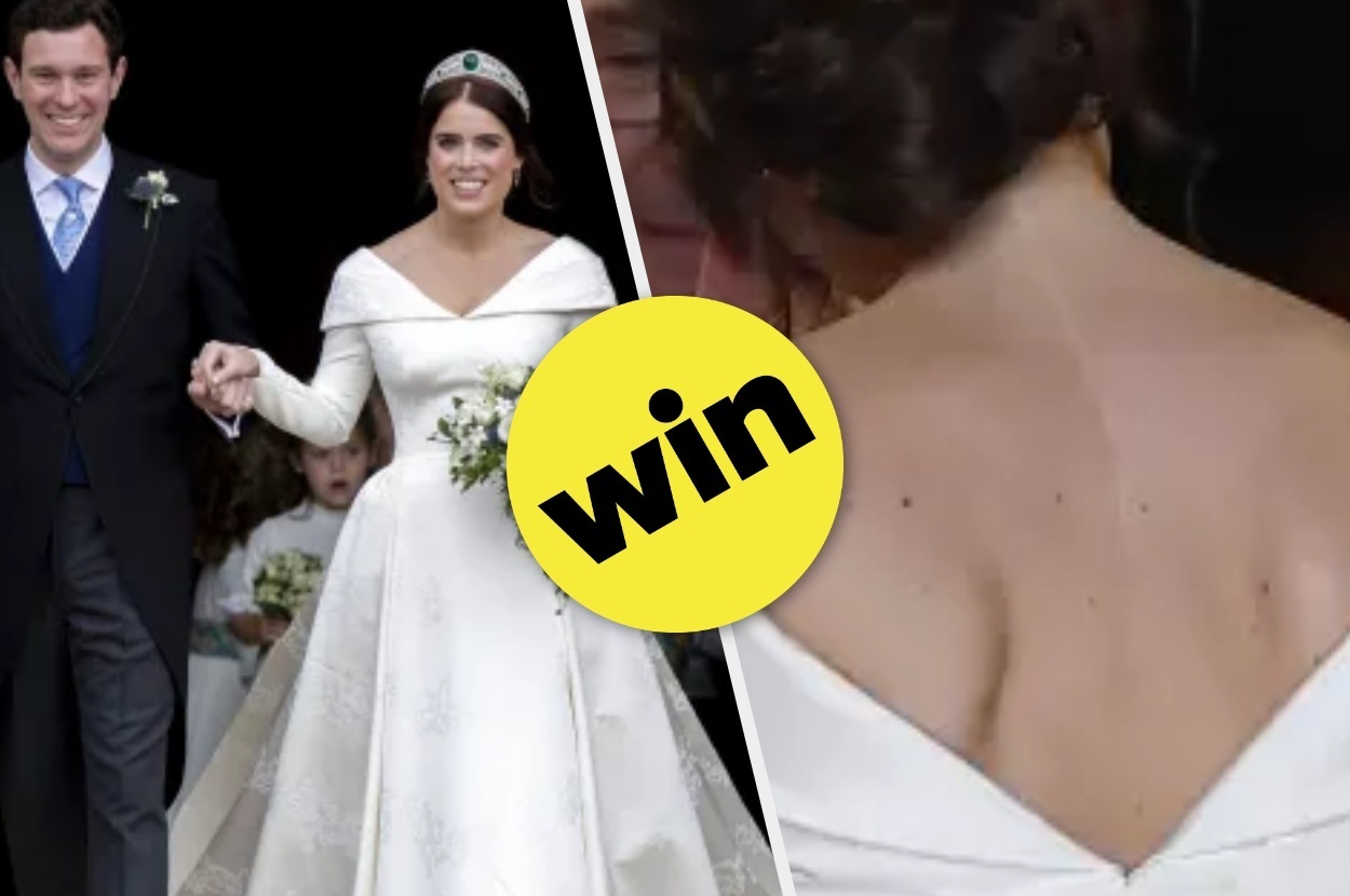 Princess eugenie shop wedding scar