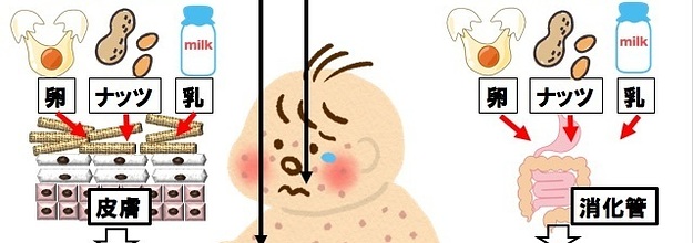 離乳食は 早く始める 遅らせる