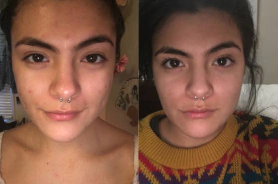 Here S Why This Moisturizer May Be The Best One You Ll Ever Use