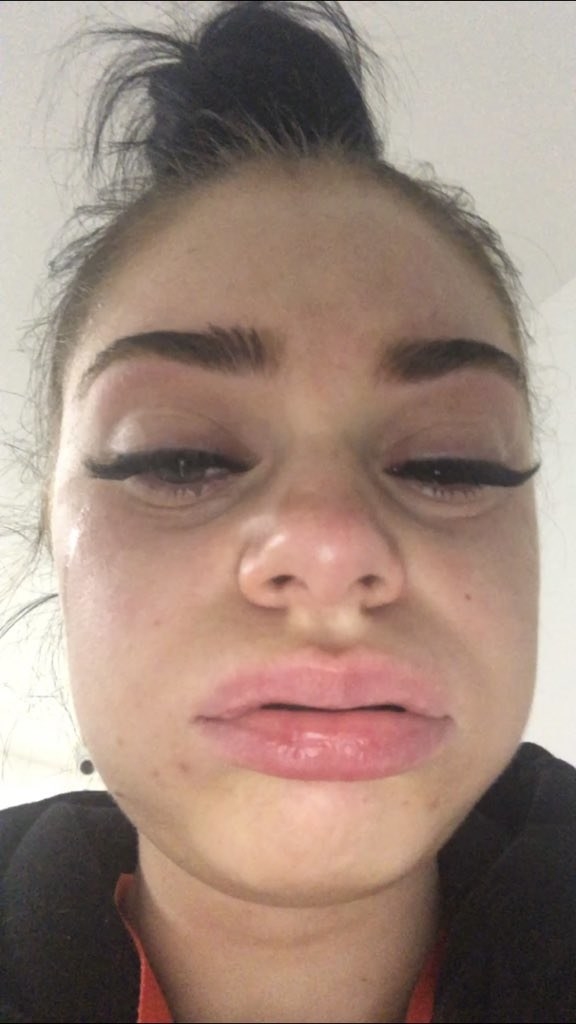 This Woman Got Eyelash Extensions And Everything Went Horribly Wrong
