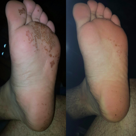 17 Products That Might Actually Help With Foot Fungus