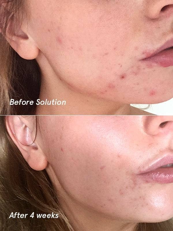 a before and after photo of a person who used the solution