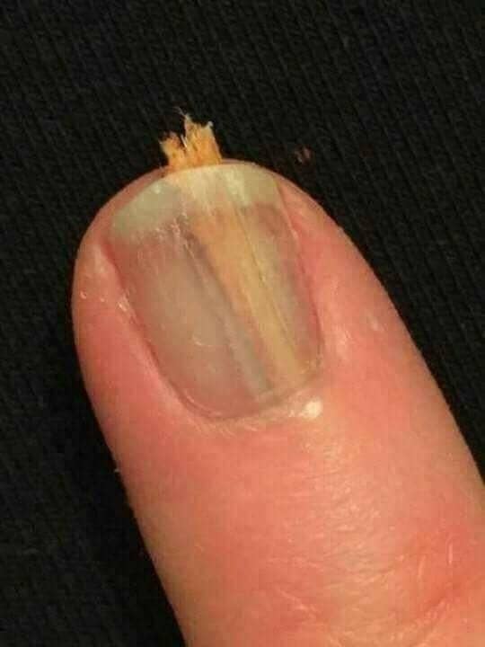 17 Photos Of Body Parts That Will Make You Squeamish For Sure