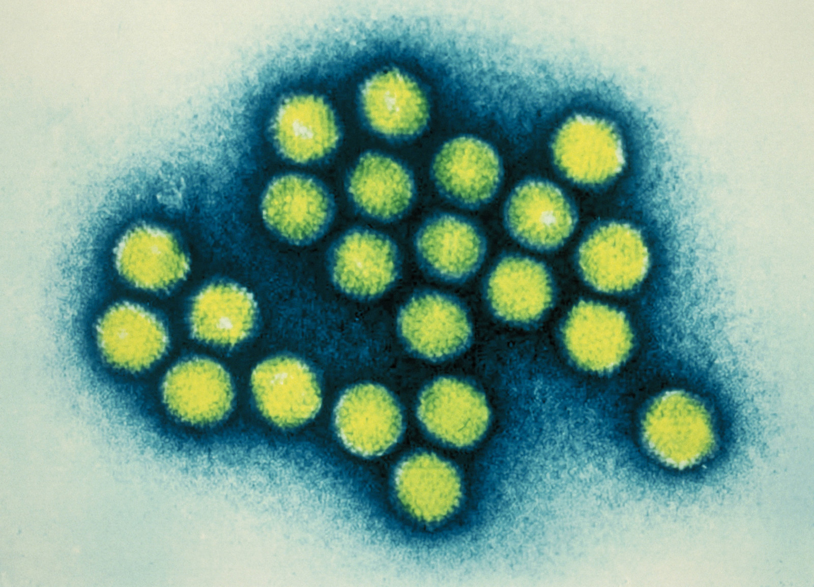 What To Know About Adenovirus, Which Killed A College Student And 11 ...