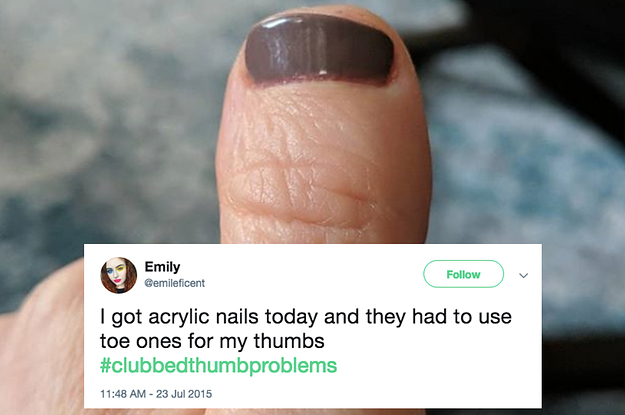 19 Things You'll Only Understand If You Have Clubbed Thumbs