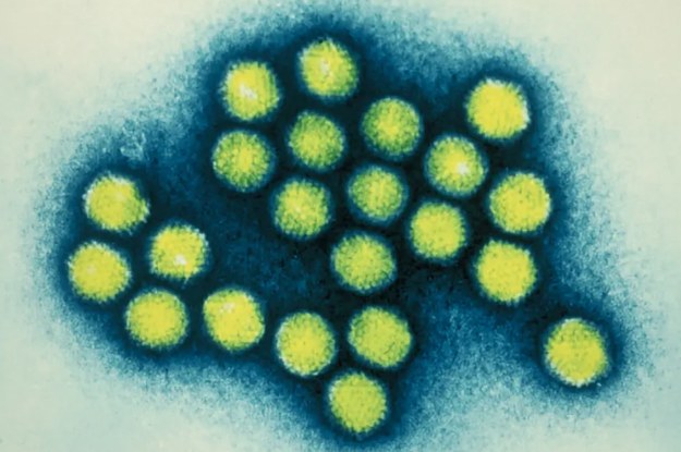 What To Know About Adenovirus, Which Killed A College Student And 11 ...