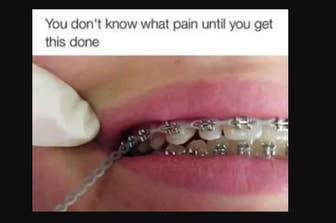 What Color Braces Should I Get Quiz Buzzfeed Change Comin Well i think you should wear any braces you want but if you realy want help i think blonds should wear silver braces i !! what color braces should i get quiz