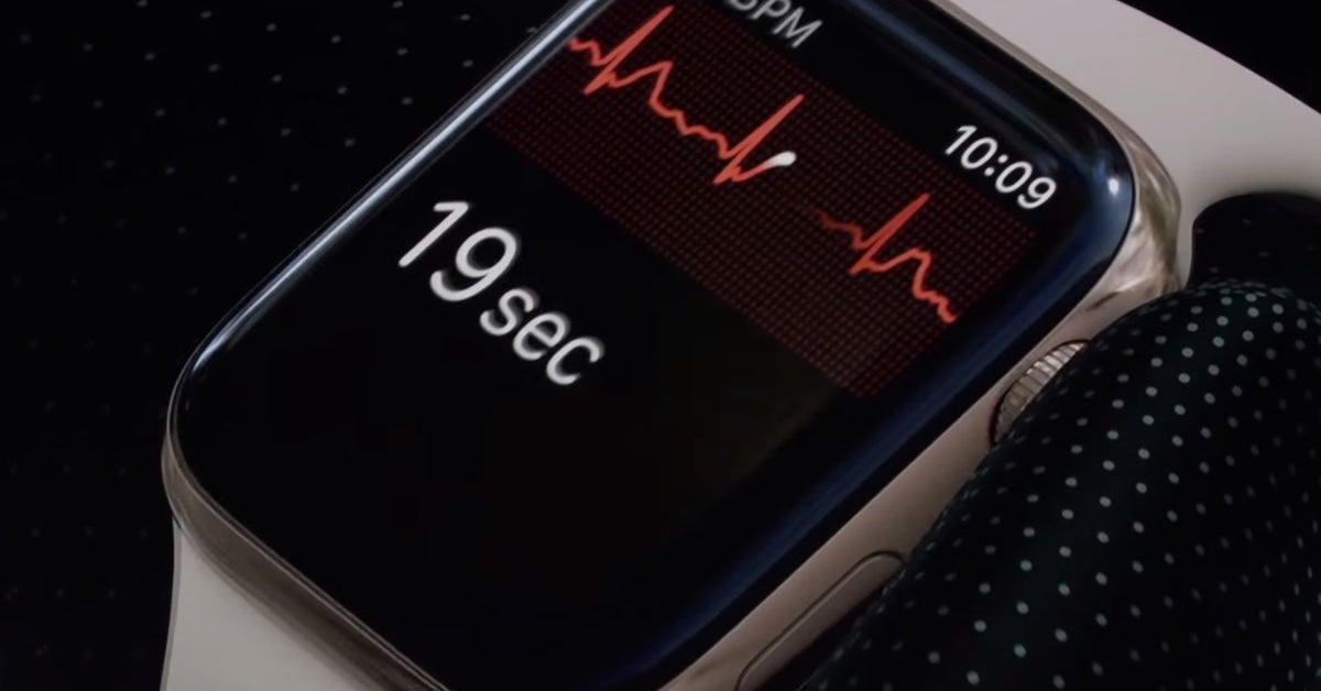 apple watch ecg hack