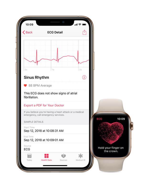 Watch Series Ecg Feature Apple Watch Ecg Apple Watch ECG