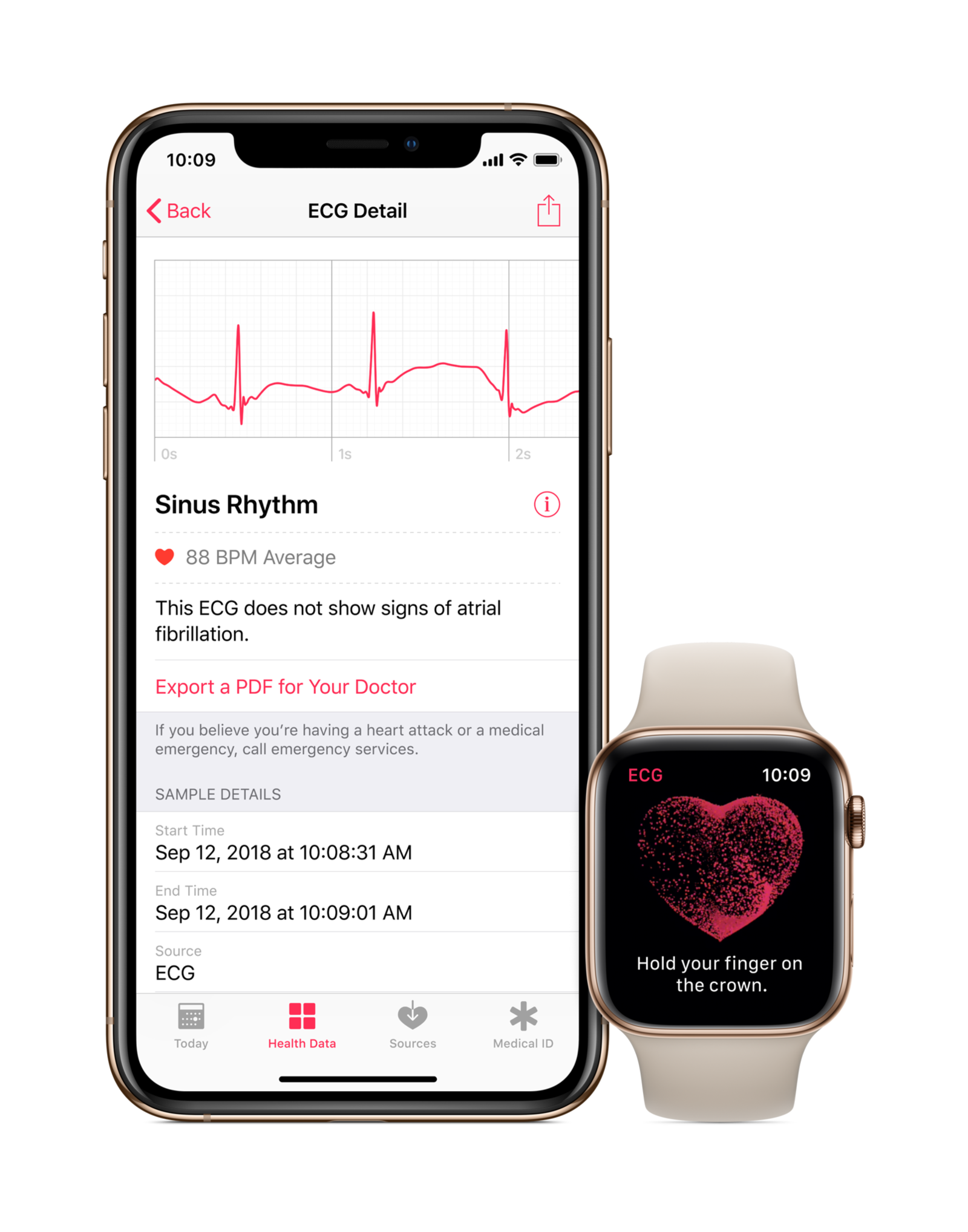 the-apple-watch-can-take-your-ekg-starting-today