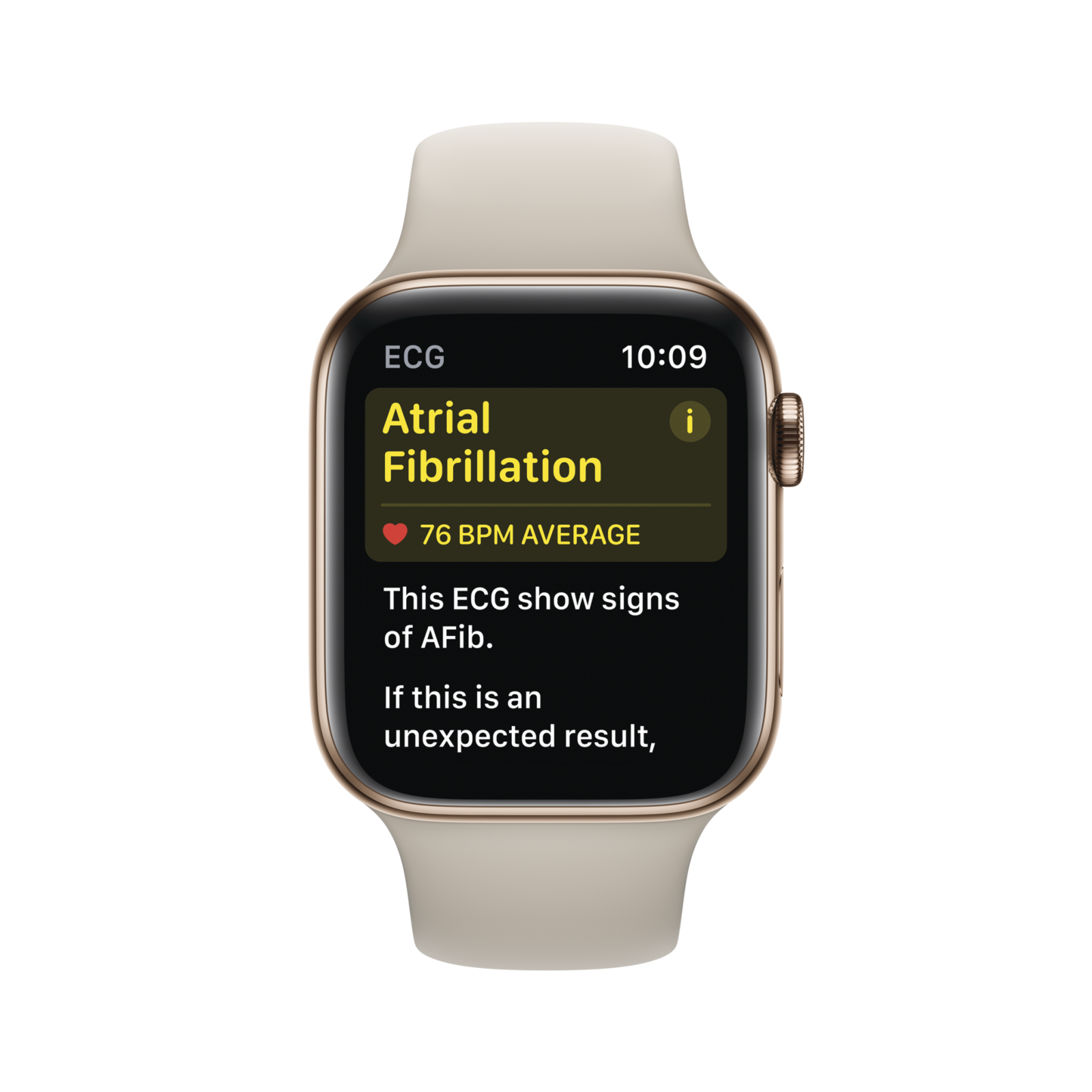 ekg feature on apple watch