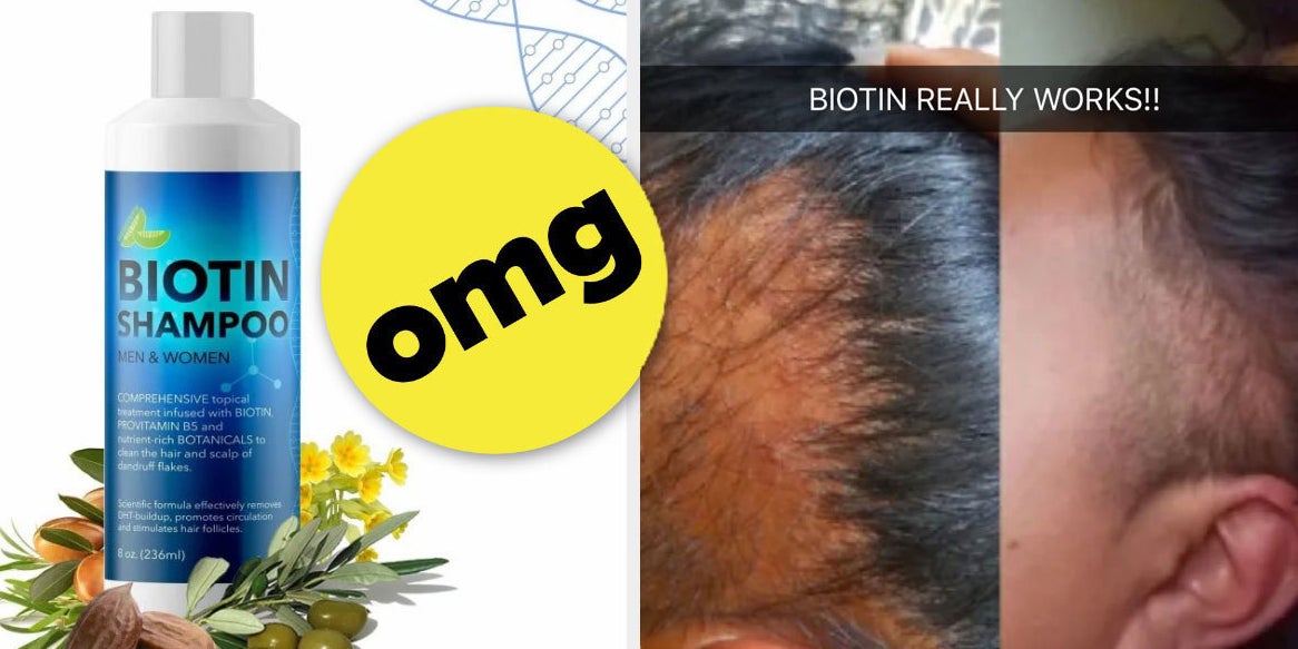 This Biotin Shampoo's Before And After Photos Will Have You Believing In