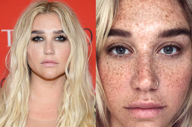 Singer Kesha Posted Pic Without Makeup And Freckles Are Beautiful