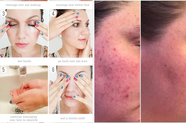 23 Ways To Get Clear Skin And Keep It That Way
