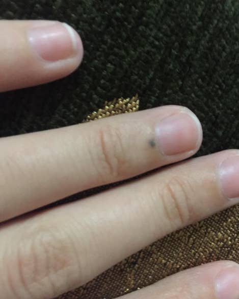 If You Were Stabbed By A Pencil And Still Have A Mark You Are Not