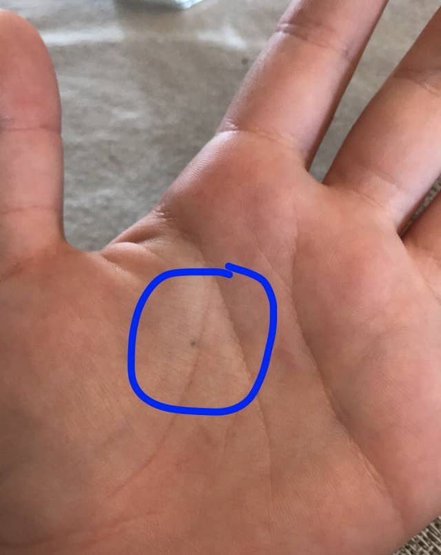 If You Were Stabbed By A Pencil And Still Have A Mark You Are Not