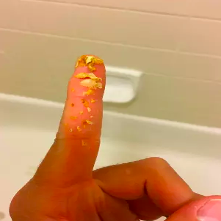 reviewer image of a finger covered in ear wax that was removed using the oil