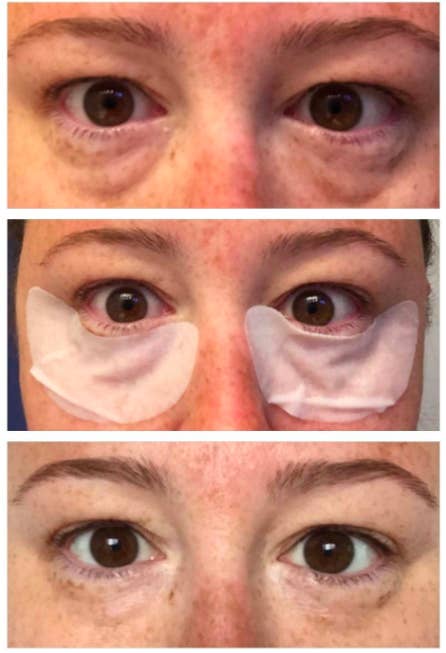 A customer review photo of before, during, and after using the Collagen Eye Zone Mask