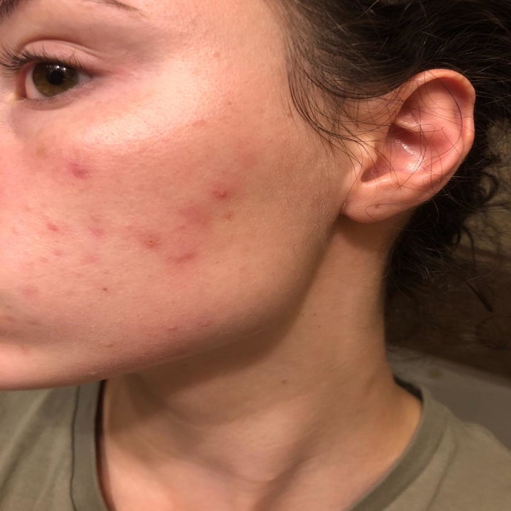 24 Things That Will Make Your Skin Clearer Than It S Ever Been