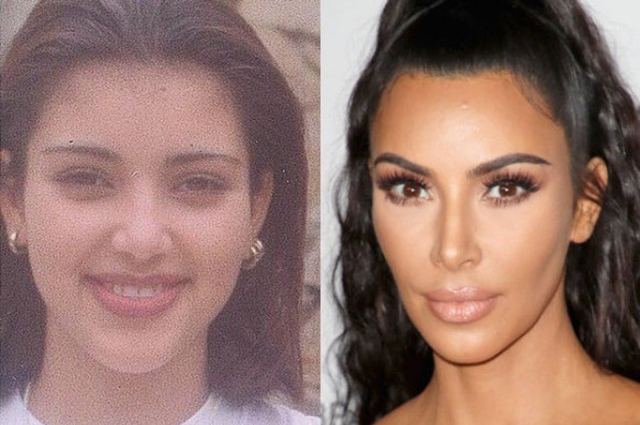 Kim Kardashian Addresses Nose Job Rumors, image size:1250x830