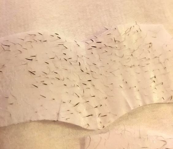 reviewer&#x27;s photo of a used strip with blackheads on it