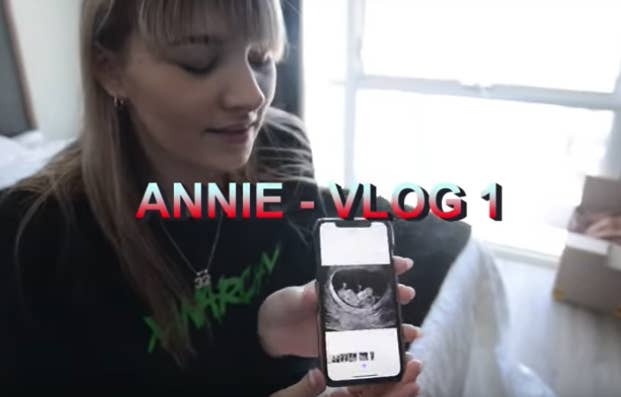 Lil Xan And His Girlfriend Annie Smith Are Being Accused Of Sharing
