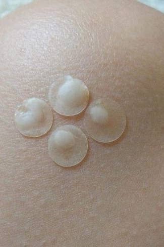 mighty pimple patches in skin 