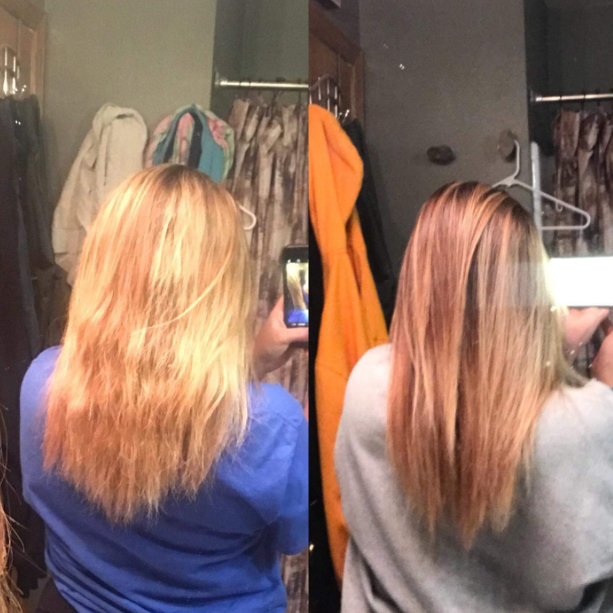 flawless hair removal before and after