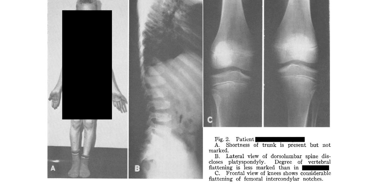 子どもの発育に関する研究で行われていた性的虐待 一部では研究論文の成果が見直されている 子どもの発育に関する研究で行われていた性的虐待 一部では研究論文の成果が見直されている