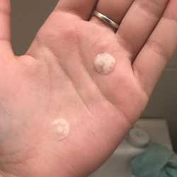 a hand holding two small, individual pimple patches
