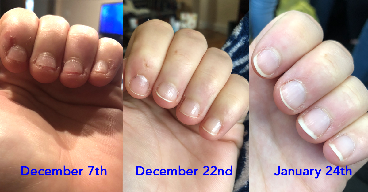 I found the best nail strengthening formula out there and it's only $8 I Found The Best Nail Strengthening Formula Out There And It's Only $8