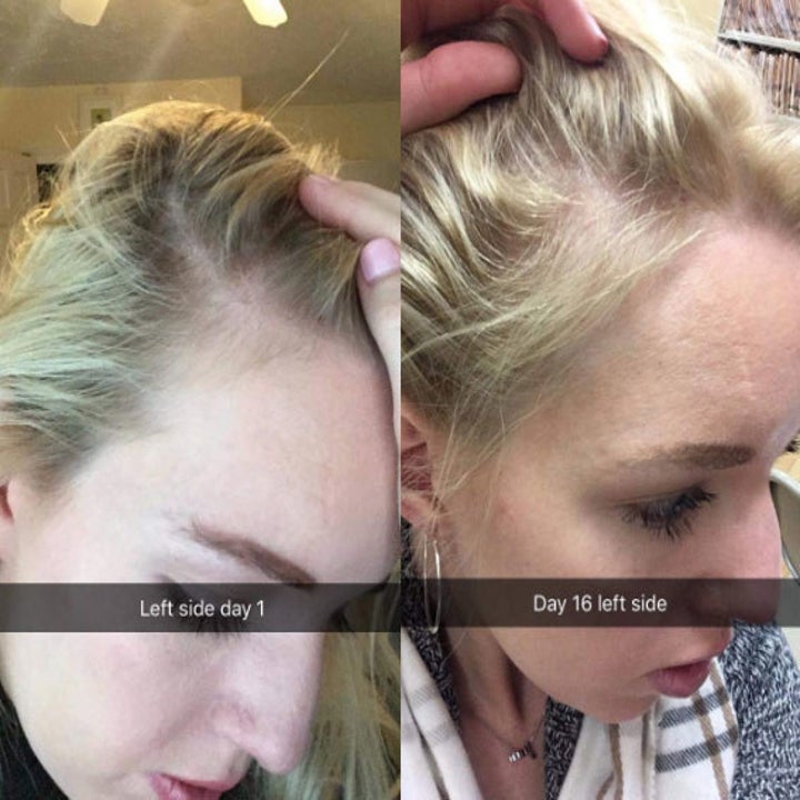 22 Products To Help You Take Care Of Your Scalp