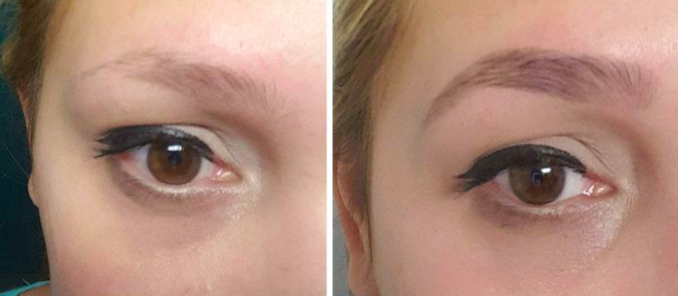 Reviewer&#x27;s before/after pic showing darker, fuller-looking eyebrows after using the dye