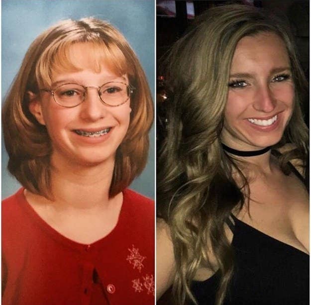 Before And After Puberty Transformations And Glow Ups