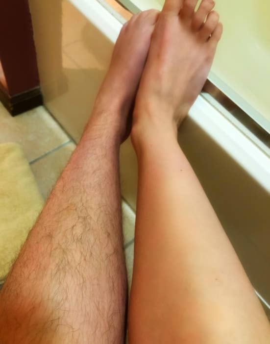 Two legs side by side, one with hair and the other shaved, highlighting hair removal results
